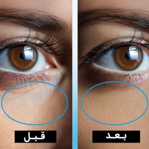 سرم دور چشم ضد چروک نیوول حاوی عصاره عسل اقاقیا 10 میل